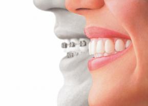ortodontie-cluj